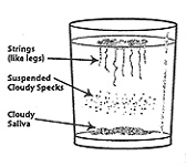 Yeast Infection Spit Test